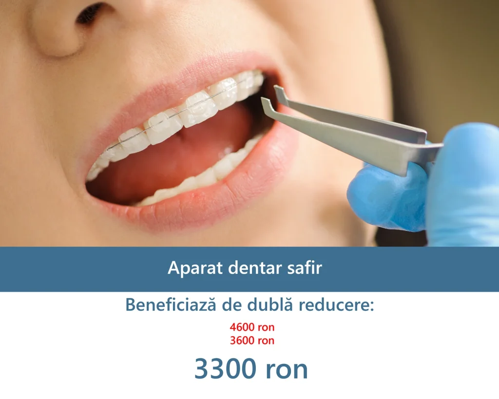 Dubla reducere metalic 1