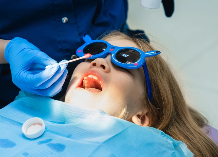 Aplicarea gelului anestezic înainte de detartraj la Smileway Timișoara