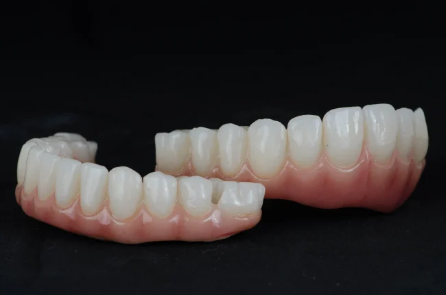 Lucrare protetică definitivă compozit - Smileway