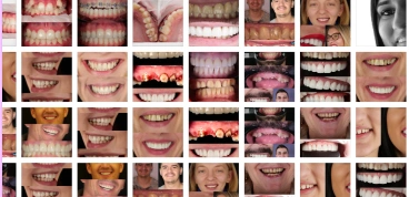 Cazuri clinica Smileway Timișoara